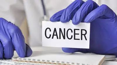 Cancer Cases To Rise 77% By 2050: Experts Share Effective Ways To Reduce Your Risk