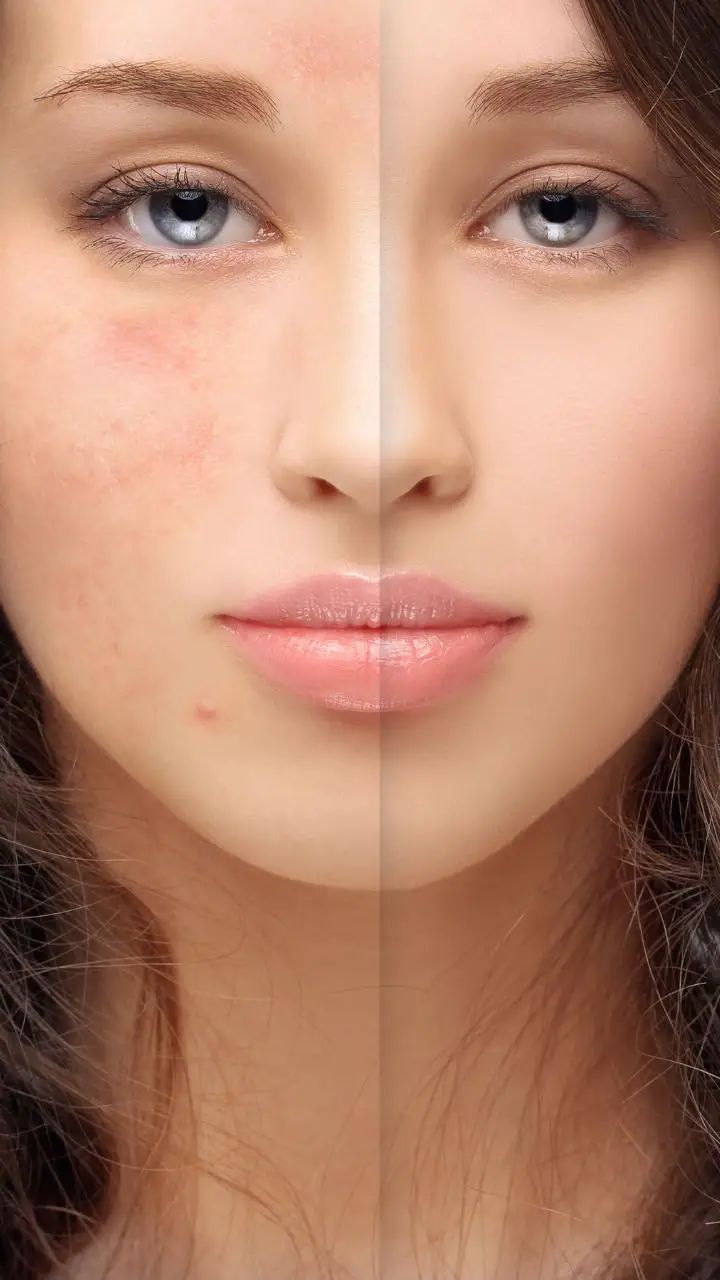 Do you really need vitamin C and retinoids for your face in your early 20s?