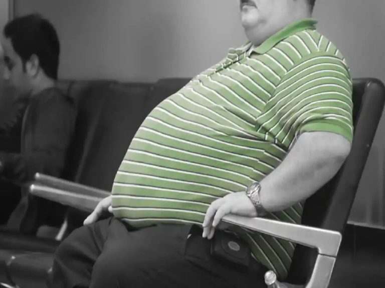 World Obesity Day 2024: Expert warns sleep apnea can lead to increased obesity risk