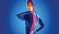 Lifestyle adjustments for managing spondylitis