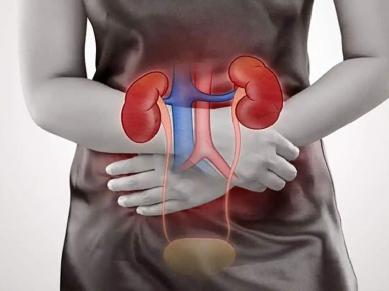 Kidney Damage Symptoms In Women: Top 7 Unusual Signs Of Severe Kidney Damage In Legs and Feet