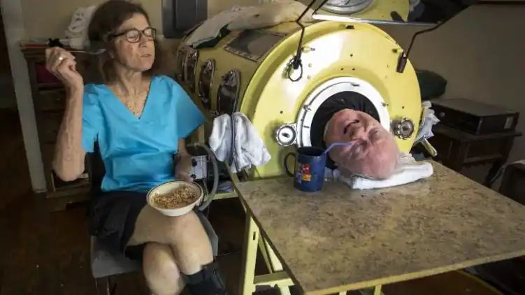 Polio-infected man from Texas who lived in iron lung for 70 years dies at 78