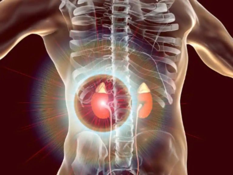 Clogged Kidney Symptoms In Men At Night: Top 7 Unusual Signs of Severe Kidney Blood Clots