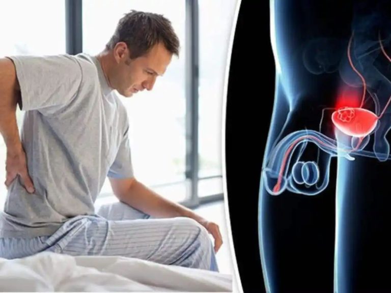 Blockages In Kidney Nephrons Symptoms: Top 7 Unusual Signs of Kidney Disorders In Men After 30s