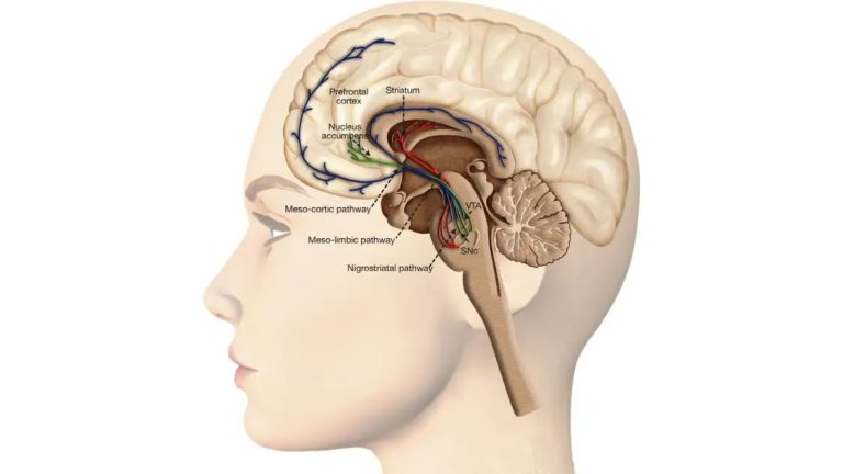 Pantothenate Kinase-Associated Neurodegeneration: A Rare Movement Disorder