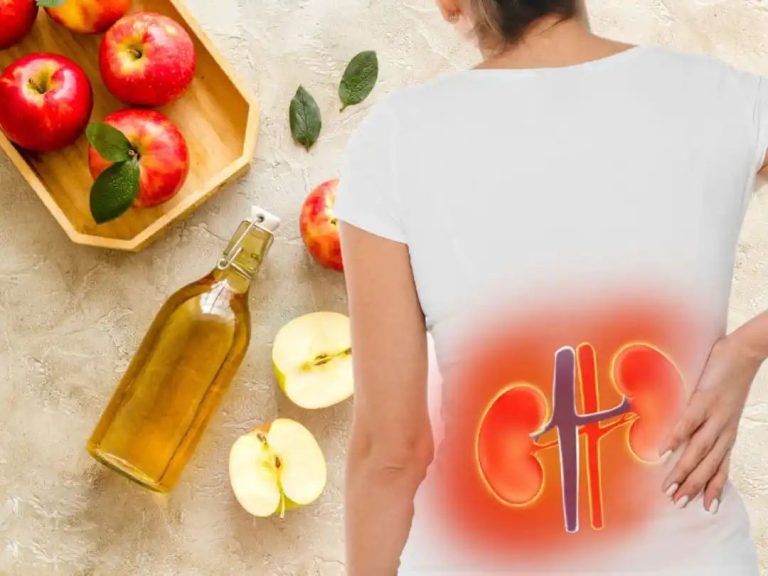 Apple Cider Vinegar On Empty Stomach For Kidney Damage: 7 Ways ACV Shots Can Help Cleanse Blocked Kidney Nephrons