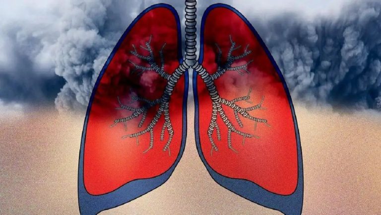 5 effective strategies to boost lung health