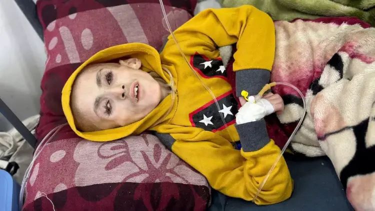 In Gaza, starving children fill hospital wards as famine looms