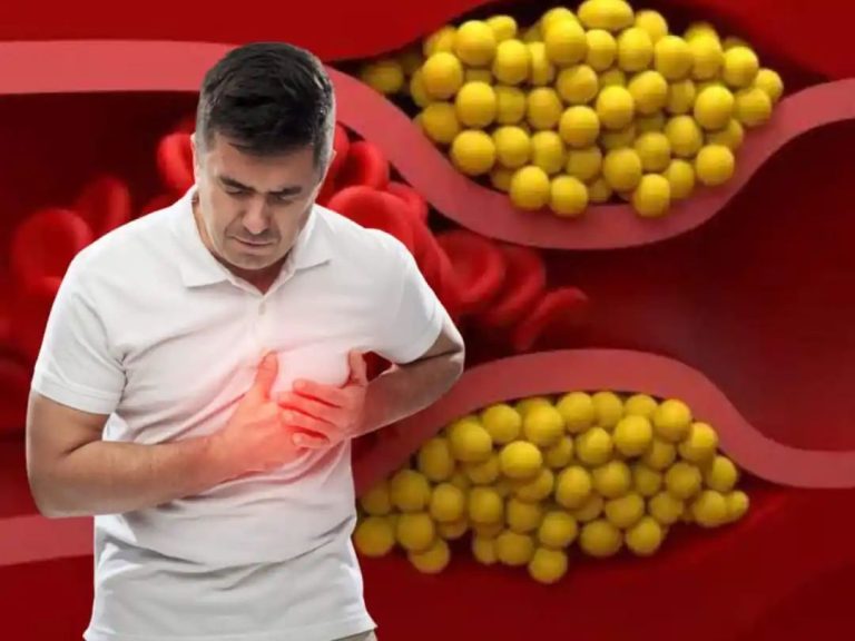 High Cholesterol In Men Management Tips: Top 10 Natural Ways To Lower Bad LDL Cholesterol Levels