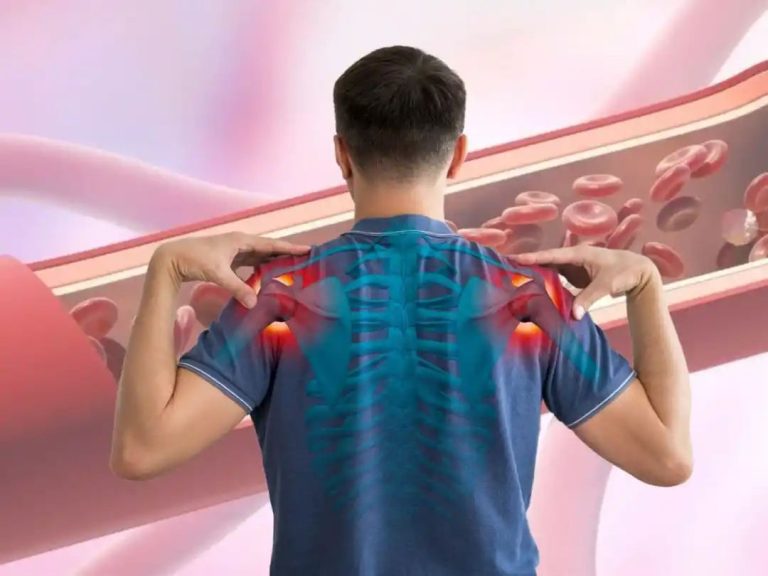 High Uric Acid Symptoms In Men 30s: Top 7 Warning Signs of High Uric Acid Levels In Shoulder And Chest