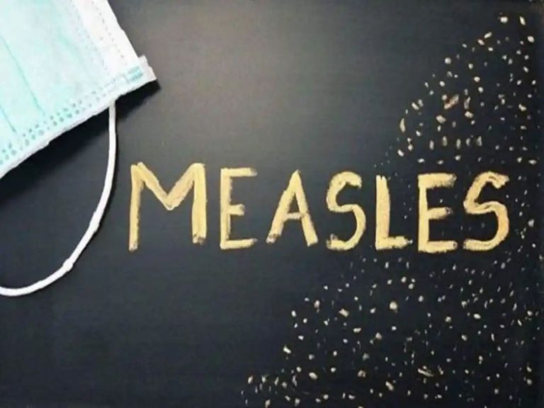 Measles Cases Rise To 64 In US: Total Number Of Cases Cross 2023 Levels, Reports CDC