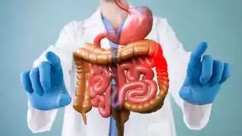 Study finds why are young people more prone to colon cancer in India