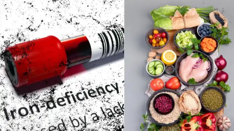 Iron Deficiency: Reason, Symptom, Treatment And All You Need To Know