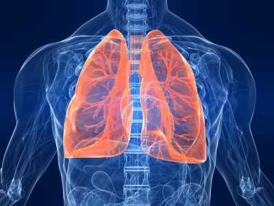 Study links colourless, odourless gas with the rise in lung cancers in non-smokers