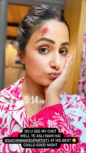 Hina Khan offers glimpses of night shoot, flaunts her ‘chot’: ‘Yeh asli nahi hai’