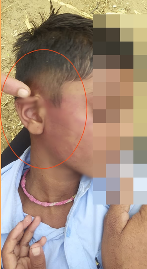 Class 3 student beaten mercilessly in Rajasthan school, teacher suspended