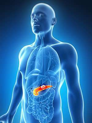 Novel method to counter chemotherapy resistance in pancreatic cancer developed