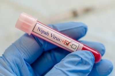 Nipah monoclonal antibody to undergo human trials in India,
 Bangladesh in 2025