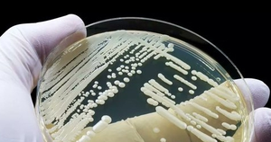 Potentially deadly fungal disease spreading in California