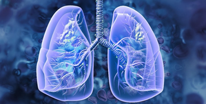 Patients with existing lung problems are more susceptible to lung cancer, warns study